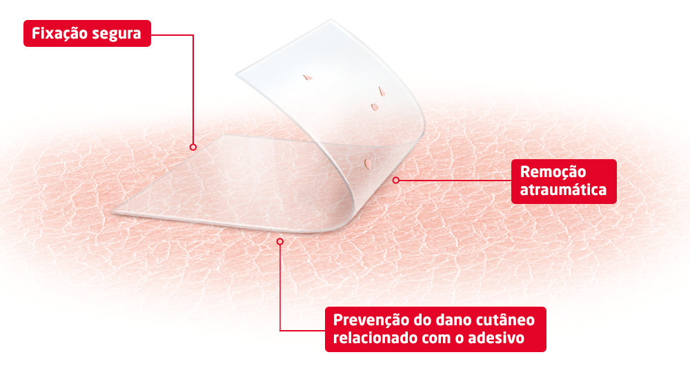 Imagem de produto que mostra benefícios da tecnologia skin sensitive: fixação segura, remoção sem trauma e prevenção de danos na pele associados a adesivos.  Imagem de produto que mostra benefícios da tecnologia skin sensitive: fixação segura, remoção sem trauma e prevenção de danos na pele associados a adesivos.
